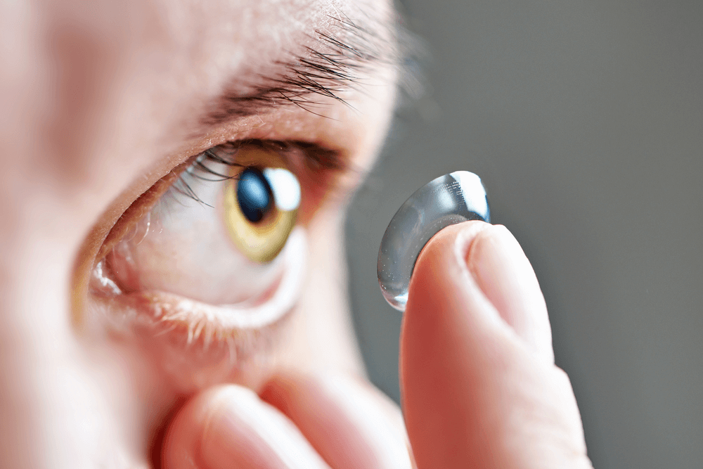 Contact Lenses Artarmon Vision